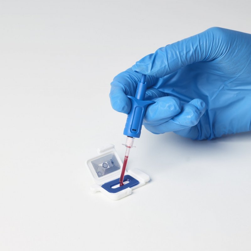 New data confirms the clinical benefit of PSP for the diagnosis of severe infections in hospitalized adults